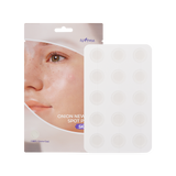 Onion Newpair Spot Patch Skin Fit 15patches - 9