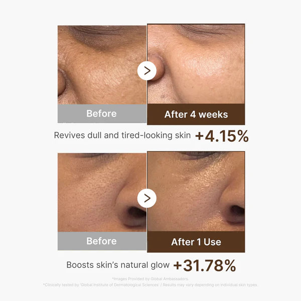 [Medicube] Deep Vita C Capsule Serum 30ml